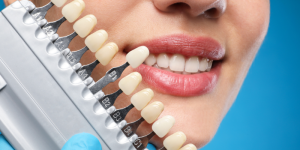 Types of Cosmetic Dentistry Procedures